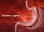 Do you know the Advantages of Bariatric Surgery Bariatric Surgery