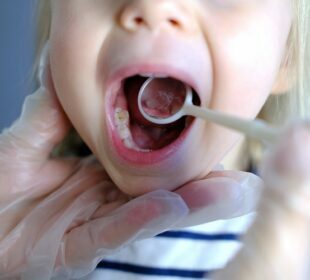 What To Do If Your Tooth Gets Knocked Out Tooth