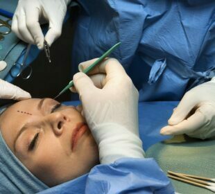 Benefits of Getting a Face Lift Procedure Face Lift Procedure