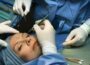 Benefits of Getting a Face Lift Procedure Face Lift Procedure