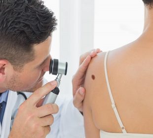 Why you should check your skin moles frequently skin moles