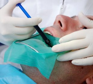 The Procedure for Root Canal Treatment Root Canal Treatment